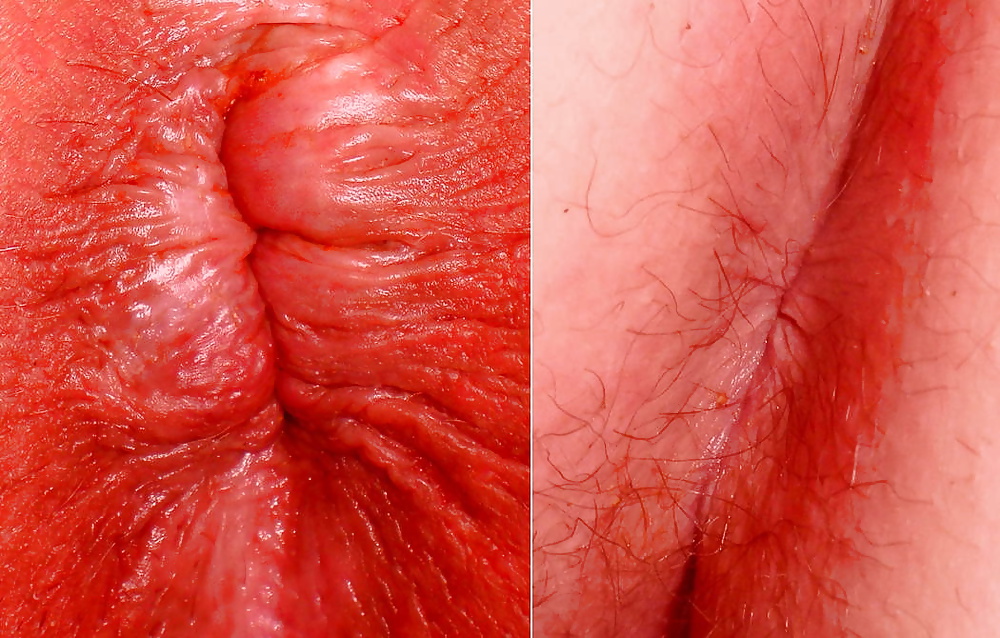 Mi agujero del culo - fotos chicos hicieron antes o después del sexo anal
 #35519816