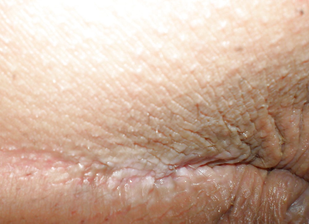 私の肛門 - 男子のアナルセックス前後の写真
 #35519851