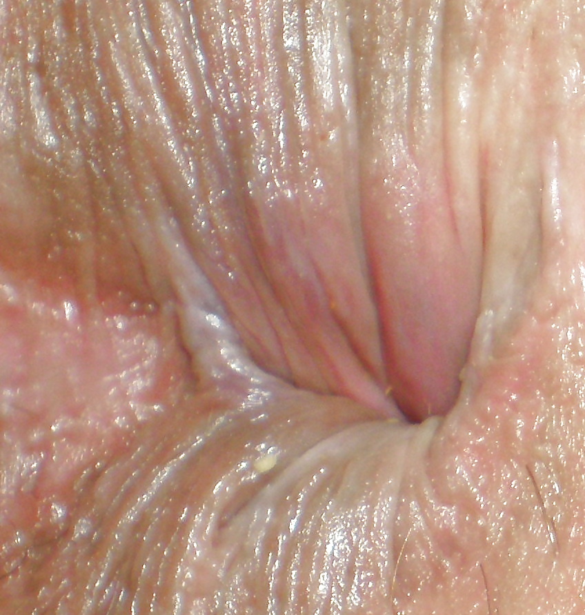My butthole - pics boys made before or after anal sex #35519860