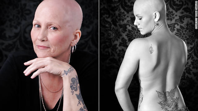 Sexy Bald Women - Kel Kadinlar #29484096