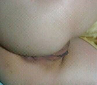 Panamenian md
 #37296064