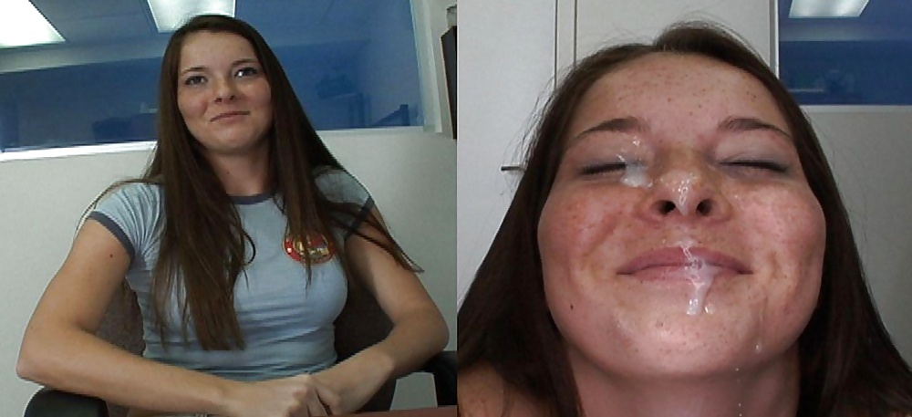 Raccolta prima e dopo i trattamenti del viso
 #28797223