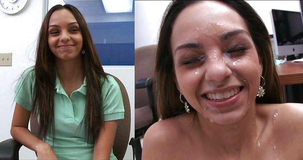 Raccolta prima e dopo i trattamenti del viso
 #28797307