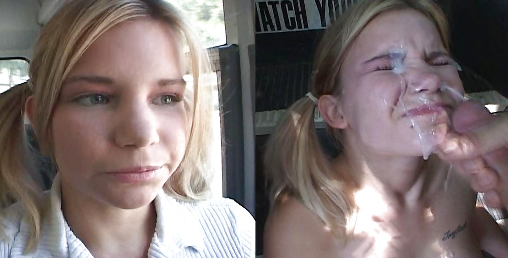 Raccolta prima e dopo i trattamenti del viso
 #28797404