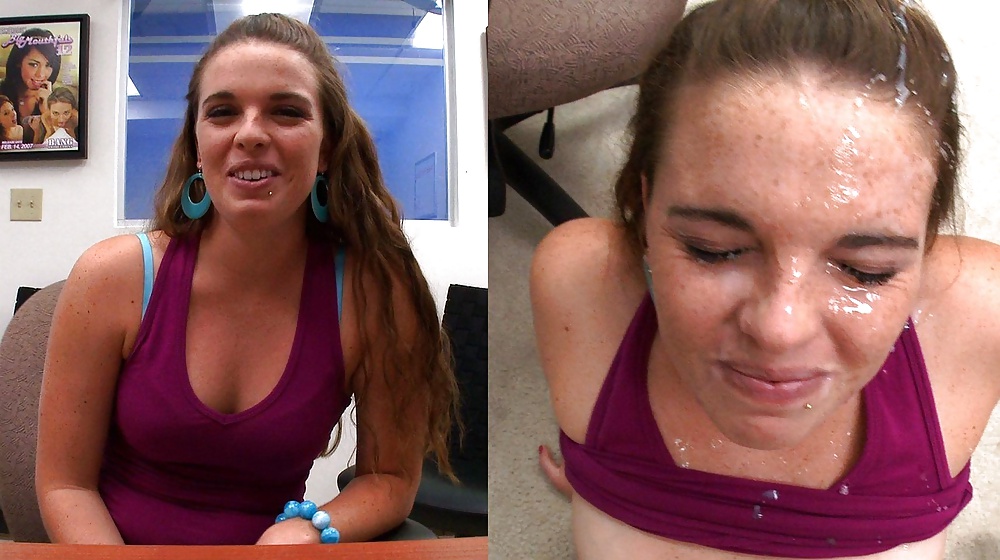 Raccolta prima e dopo i trattamenti del viso
 #28797409