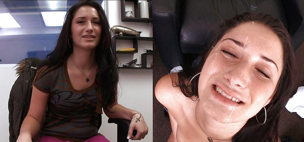 Raccolta prima e dopo i trattamenti del viso
 #28797439