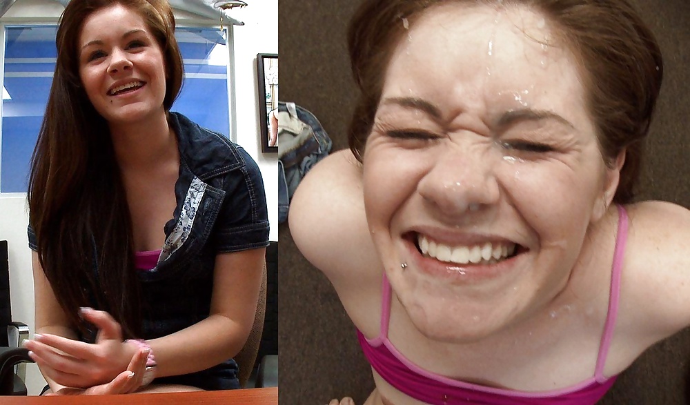 Raccolta prima e dopo i trattamenti del viso
 #28797474