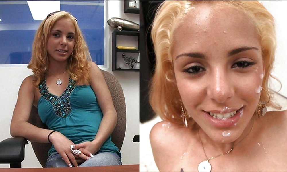 Raccolta prima e dopo i trattamenti del viso
 #28797608