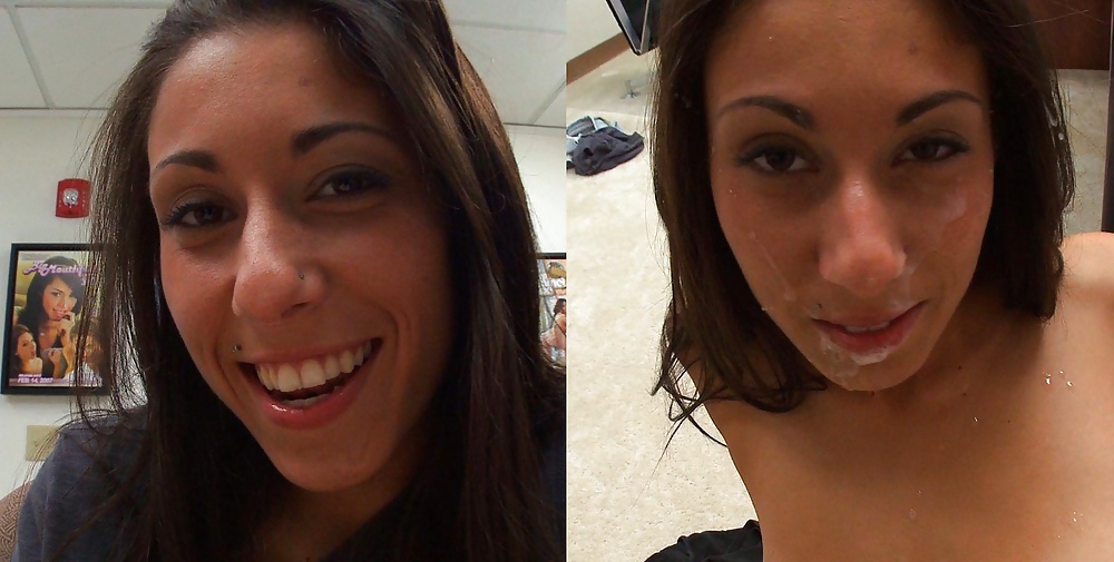 Raccolta prima e dopo i trattamenti del viso
 #28797615