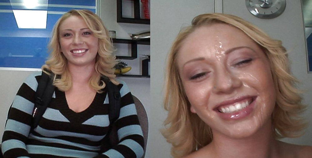 Raccolta prima e dopo i trattamenti del viso
 #28797678