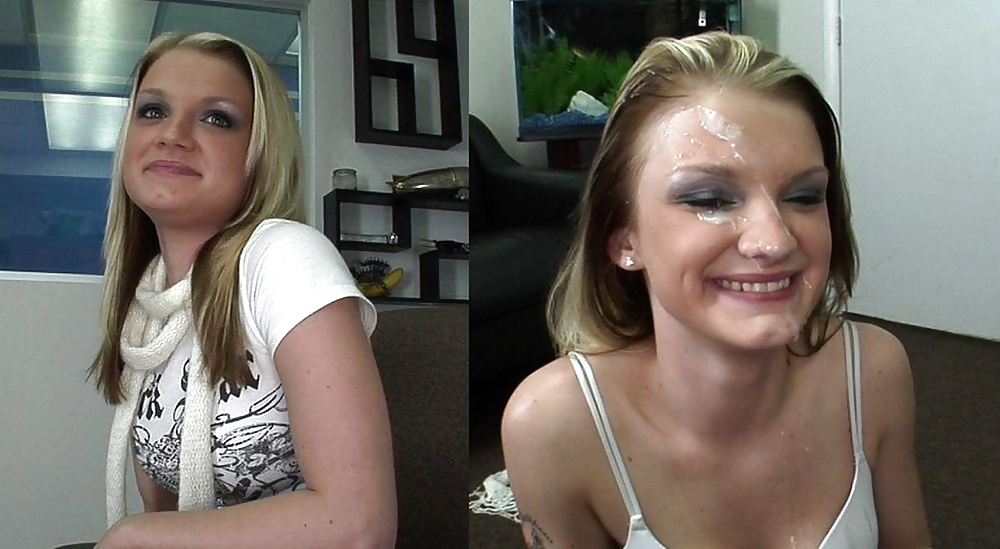 Raccolta prima e dopo i trattamenti del viso
 #28797719