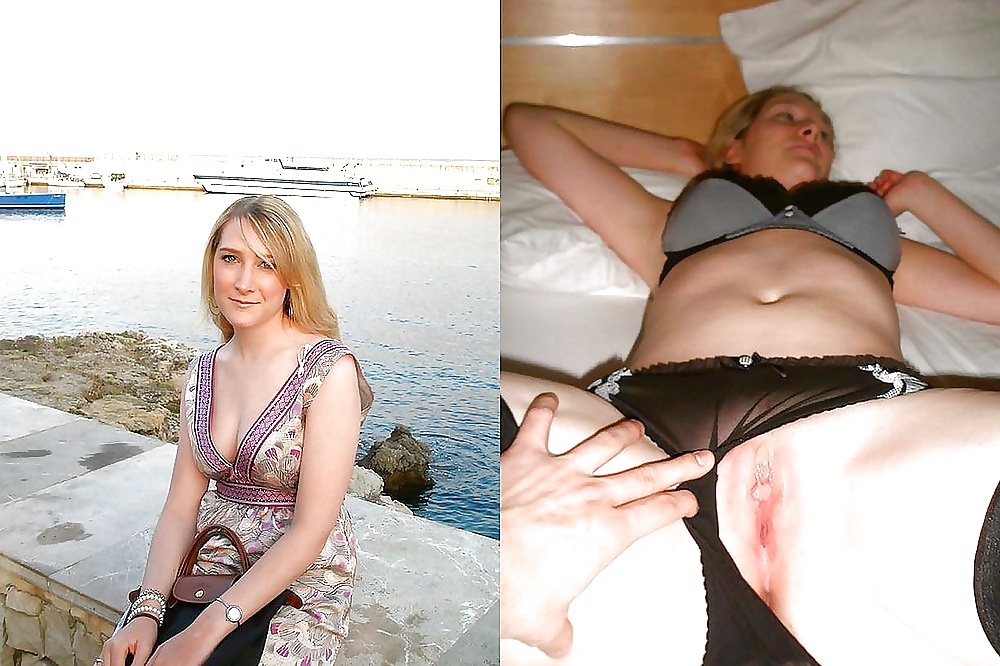 166- BEFORE AND AFTER 7 #31402796