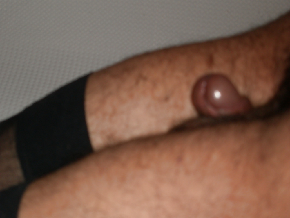 Tear in my nylons
 #33984696