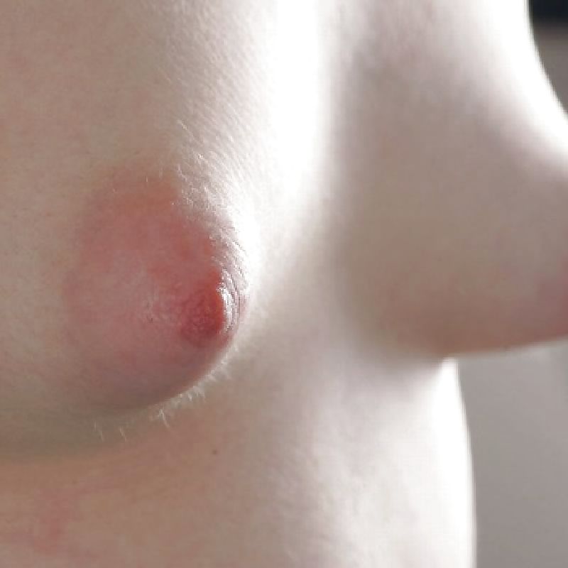 Tits nips & puffies - part 7
 #35760910