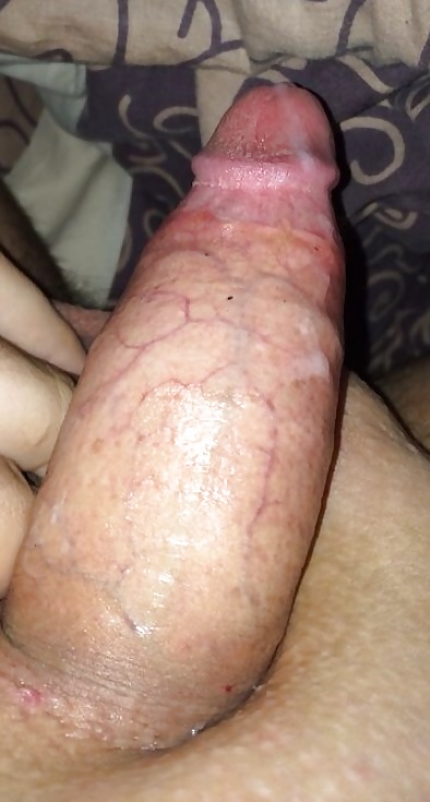 Steiferschwanz  #32815093