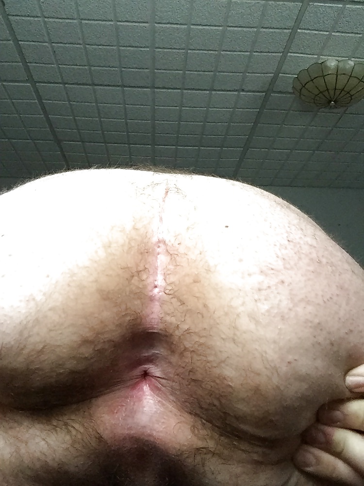 Me, Fatter Than Before #41024066