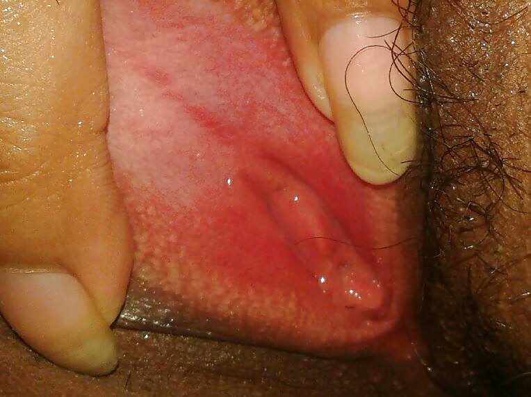 プッシー1
 #25609168