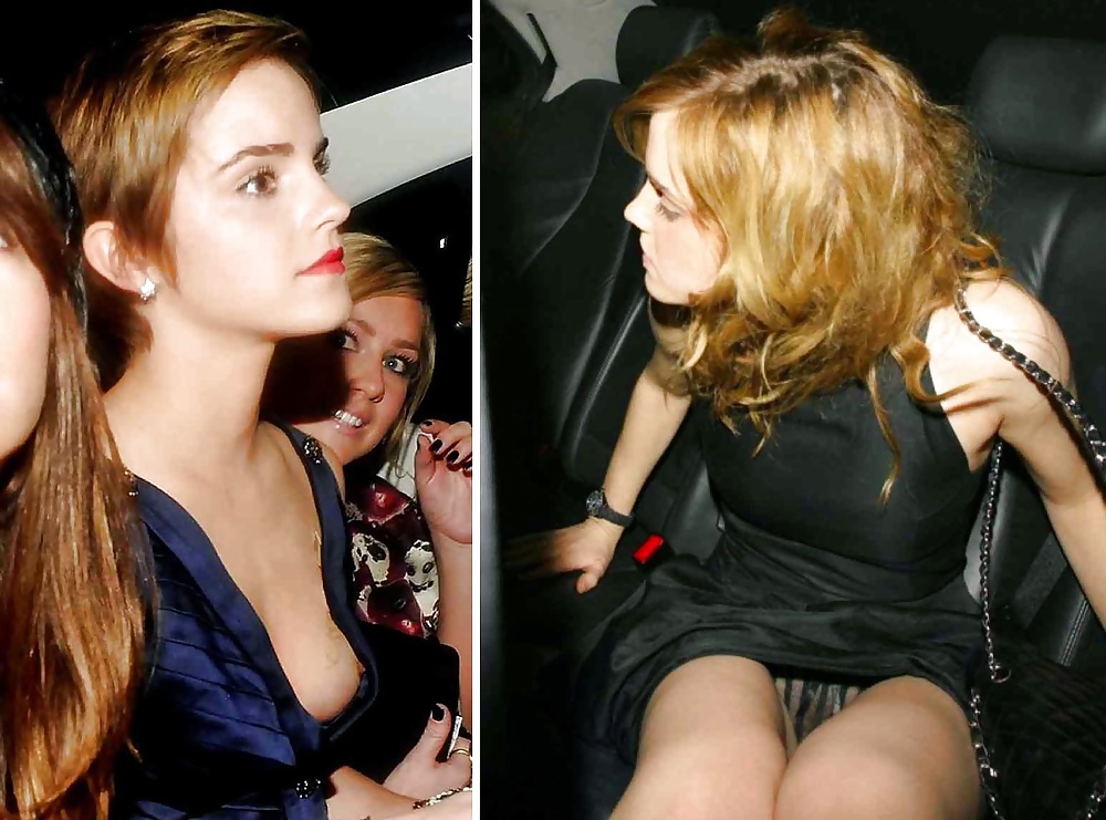 Emma watson cespuglio peloso e nip slip
 #35495253