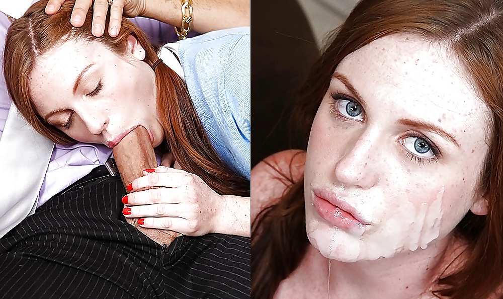 Facails before and after #29257777