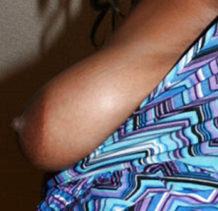 Big black areolas part 36 #41016164