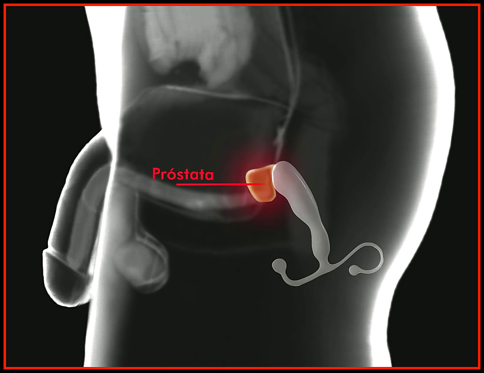 Aneros - massage de la prostate - masaje de la próstata
 #31682434