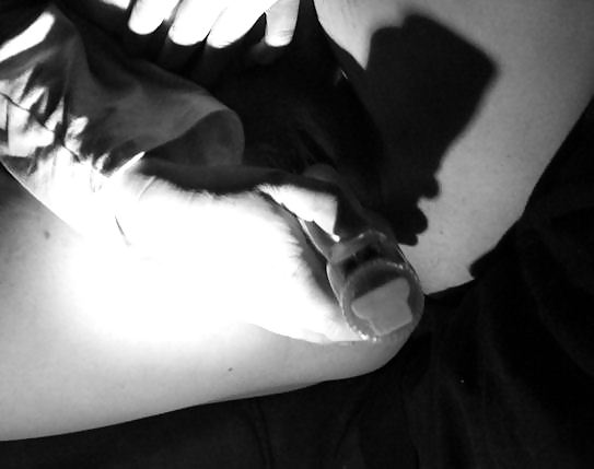 Up close  #35849333