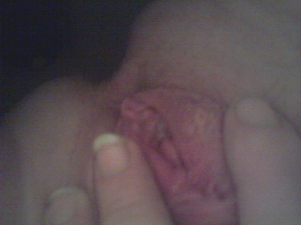 Pritty coño
 #34435439