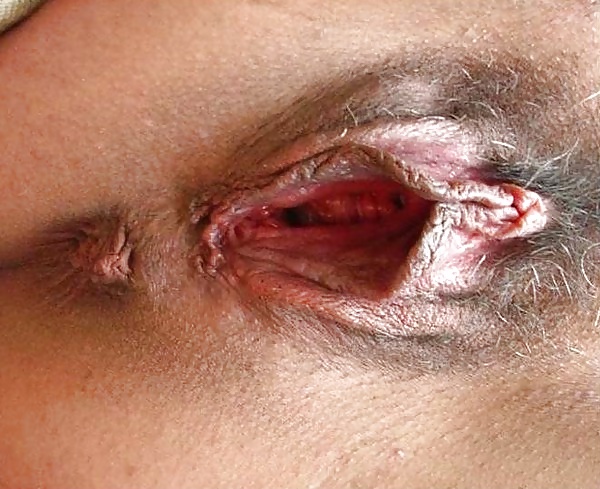 Rosette 17 #32055038