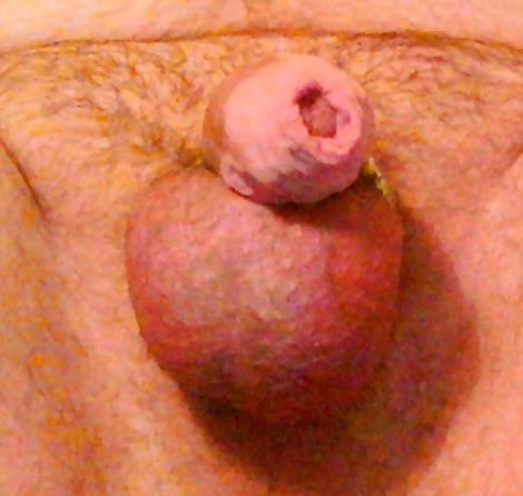 Schlauchschelle #29372980