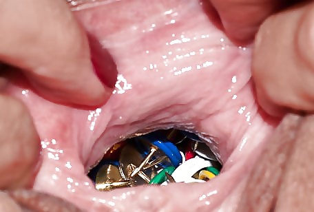 Diga ahhh...
 #25482417