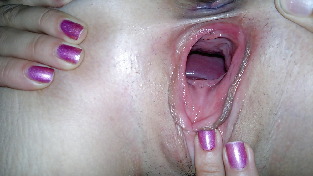 Diga ahhh...
 #25482516