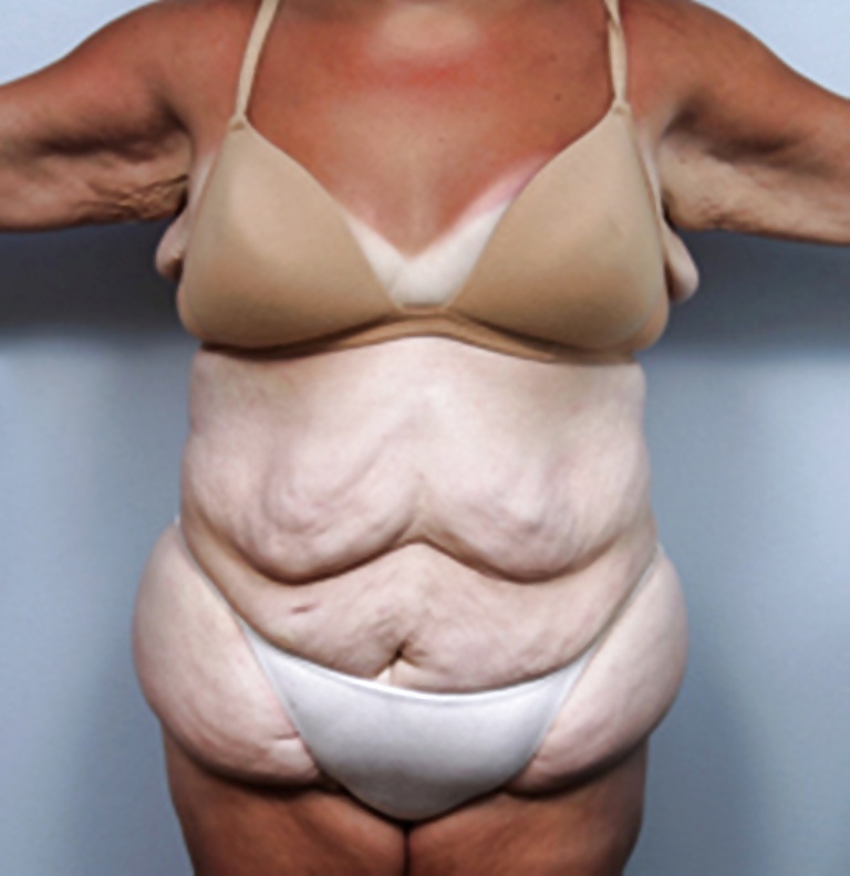 Types of bodies that excite me part 16 #40715083