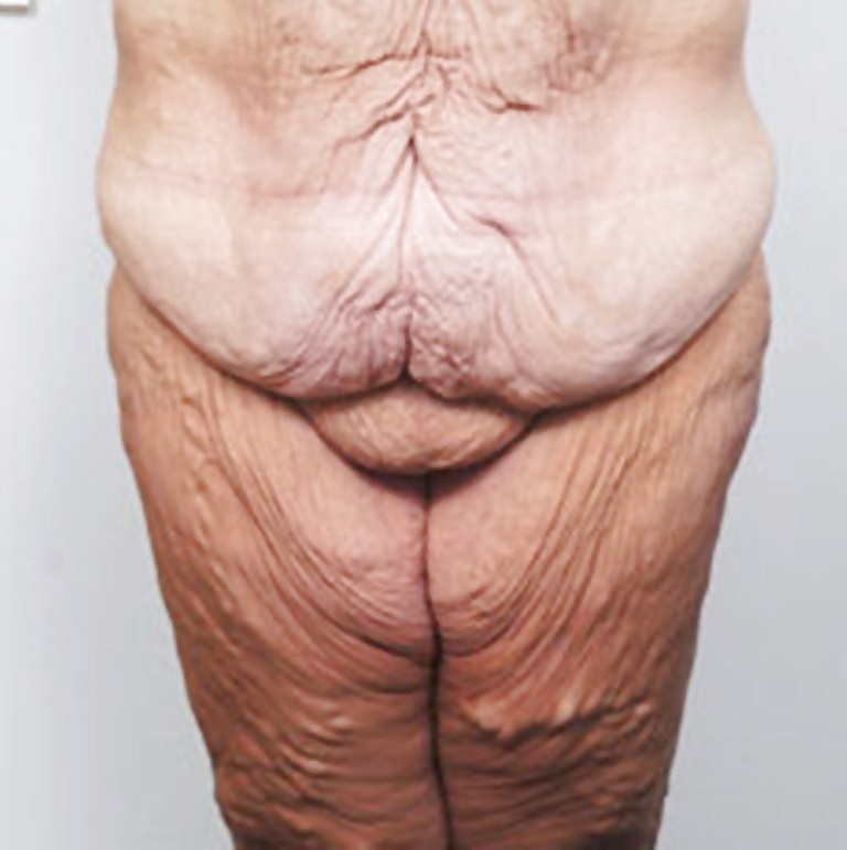 Types of bodies that excite me part 16 #40715144