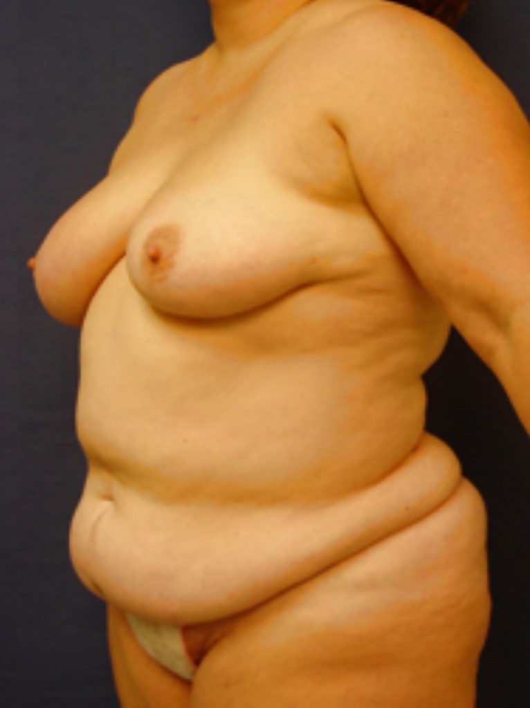 Why change the body part 9 #28419430
