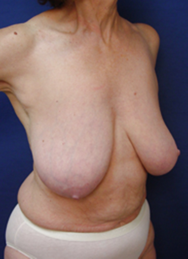 Why change the body part 9 #28419486