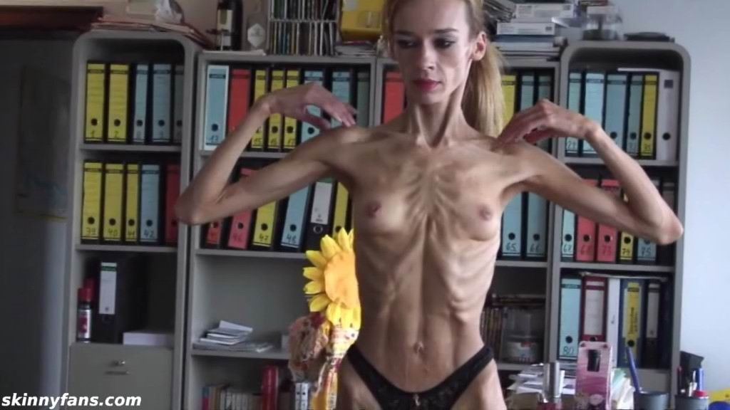 anorexic girl Inna showing veins and bones #67300056