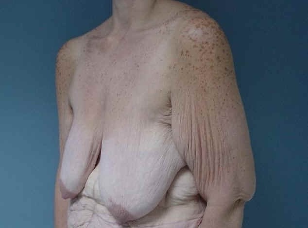 Older Grannies and matures showing their wrinkled bodies #67569799
