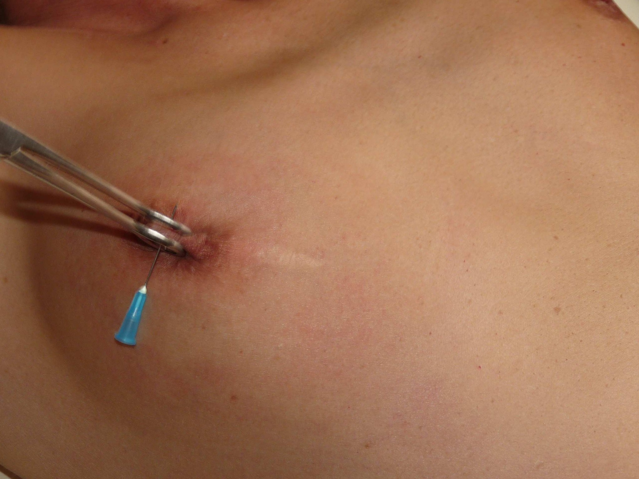 Extreme Amateur-Nadel-Schmerzen und Nippel-Piercing-Folterungen der europäischen Painslut pu
 #72055051