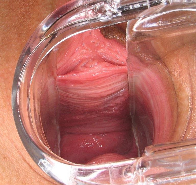brunette does hard speculum games #73226818