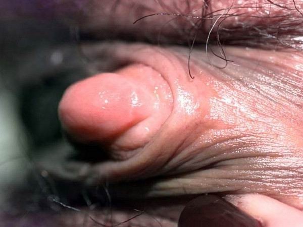 Riesige geschwollene fleischige Klitoris Nahaufnahmen
 #73224278