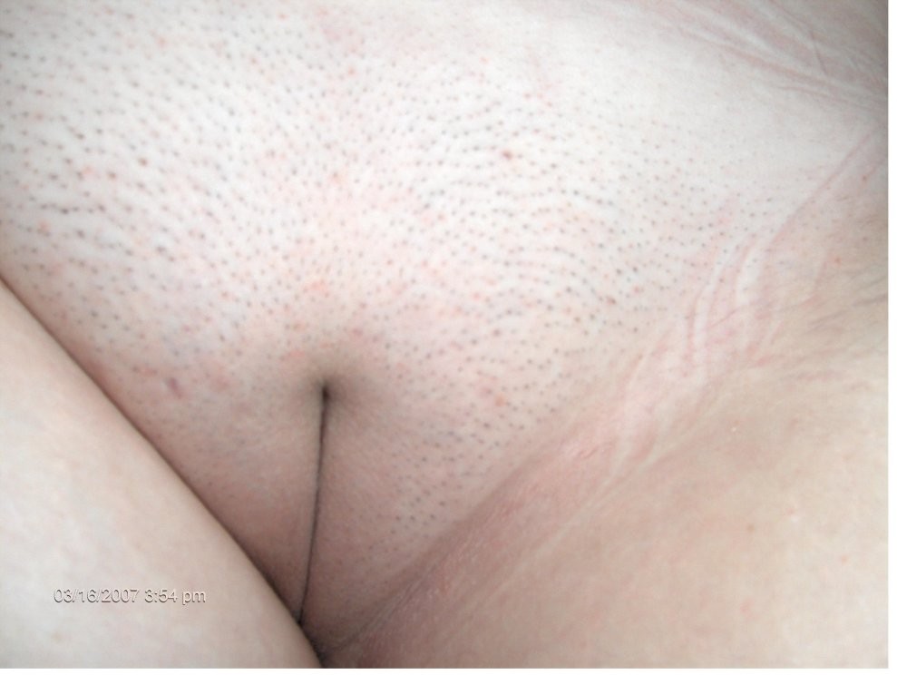 Babes zeigen fantastische Muschis in Tangas
 #77120653