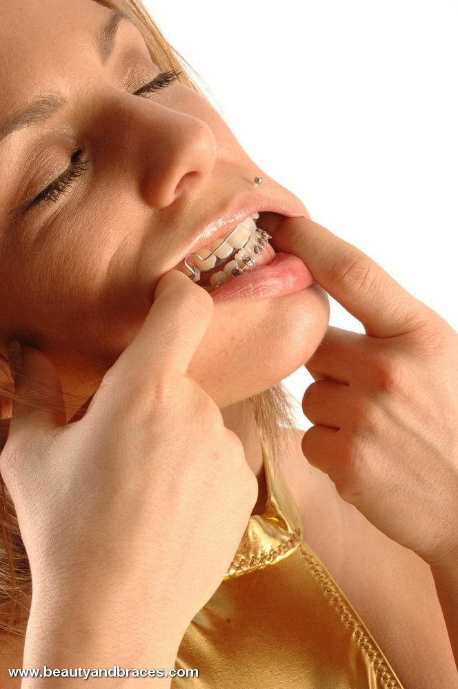 ゴールドのビキニに身を包んだ歯列矯正中のブロンド女性
 #73185822