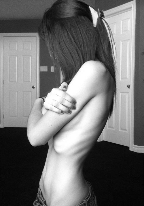 Bellezas anoréxicas delgadas y flacas posando desnudas
 #76487609