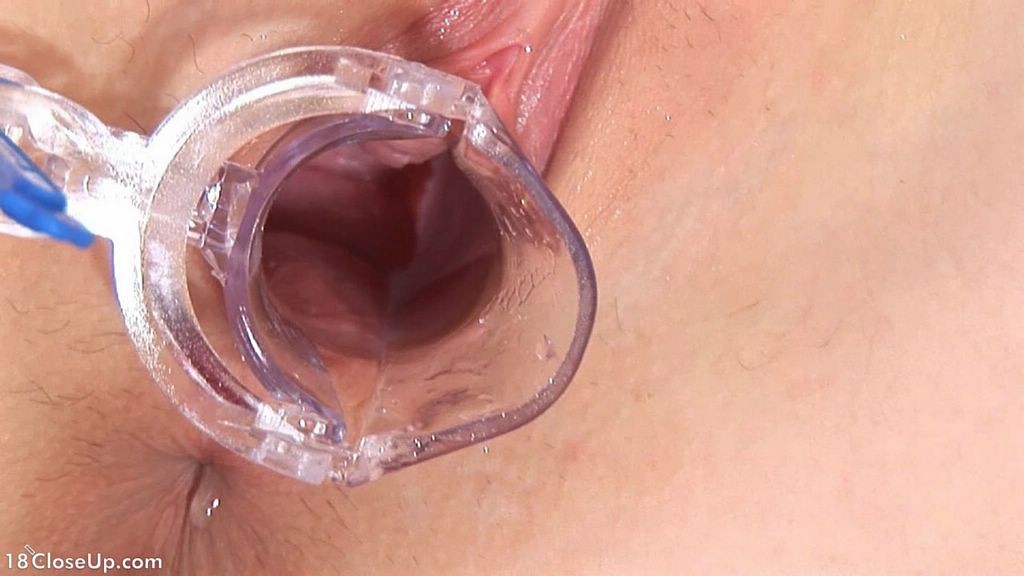 Closeups of busty teen pussy spreads with speculum #75608163