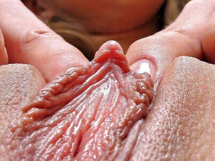 Abnormal riesige geschwollene fleischige Klitoris Nahaufnahmen
 #75609532