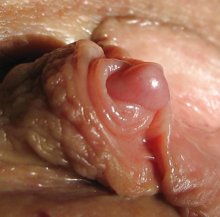 Abnormal riesige geschwollene fleischige Klitoris Nahaufnahmen
 #75609543