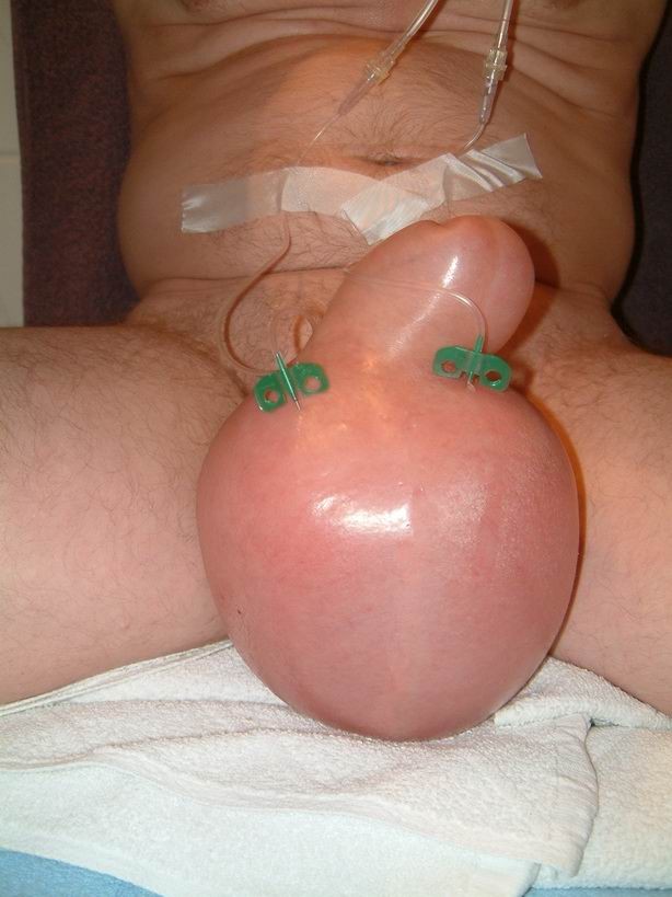 extremely pumped cocks and balls #73222459
