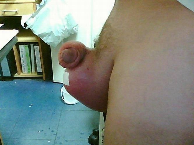 extremely pumped cocks and balls #73222551
