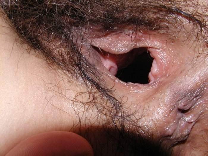 extreme pussy and anal speculum insertions #73222315