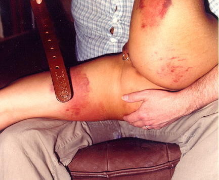 Vintage spanking und bruising beating von retro fetisch modell ra
 #71916493